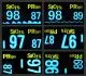 Pilot Finger Pulse Oximeter
